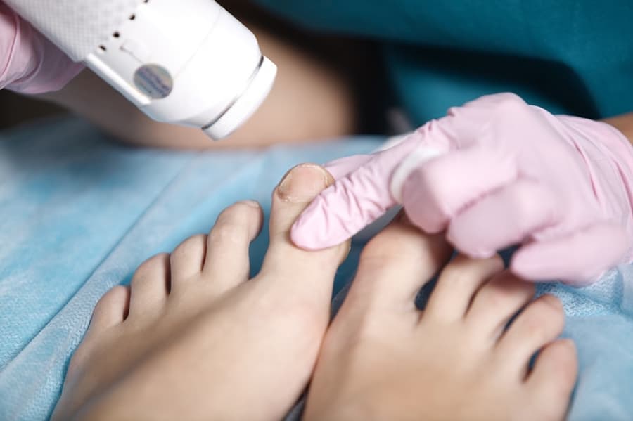 Nail Surgeries
